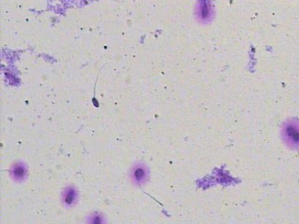 Spermiogram ZC Dravlje